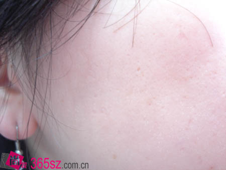 6、玫琳凱盈白面膜霜使用前后對比